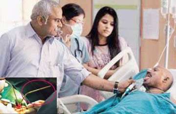 delhi doctors save worker after rod pierces his brain
