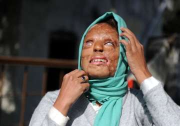 acid attacks what india should learn from bangladesh