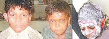 drunk youths throw boiling oil on four kids in up