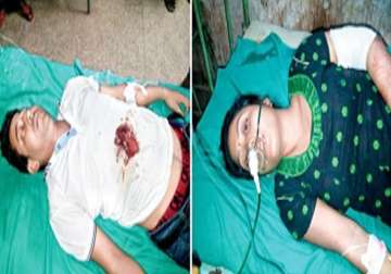 shot in the chest man drives on scooty 14 km to north bengal hospital