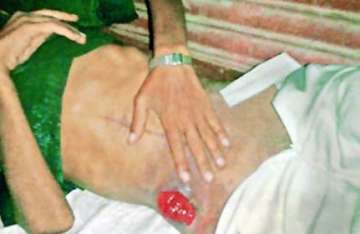 delhi hospitals dump hapless victim