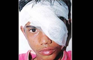 student loses eye as rss school teacher beats him up