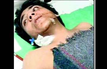 kasab may undergo stomach surgery