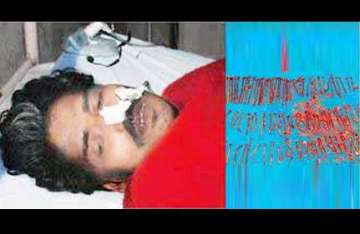 man in chhatisgarh swallows 122 iron nails