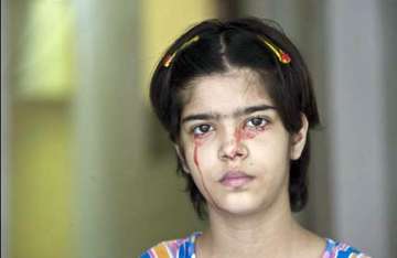 doctors baffled over lucknow girl who cries blood