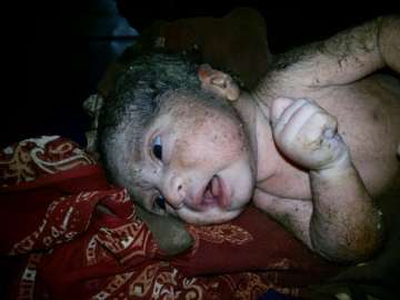 abandoned newborn baby found on roadside near mumbai out of danger