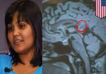 hyderabad woman s brain tumour turns out to be evil twin
