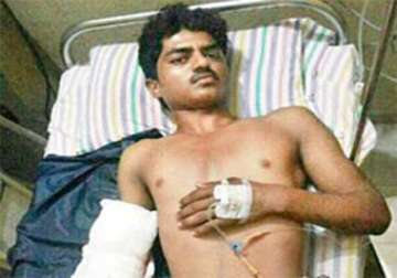 mumbai doctors reattach man s hand severed by electric saw within 8 hours