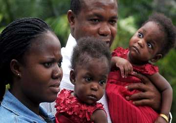 nigerian conjoined twins get new lease of life in india