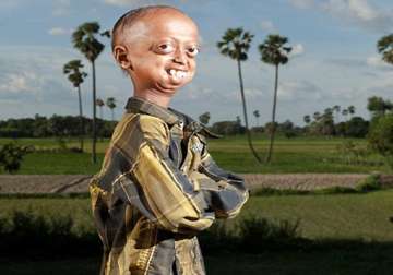 real life auro a 14 year old boy in bihar looks like a 110 year old man