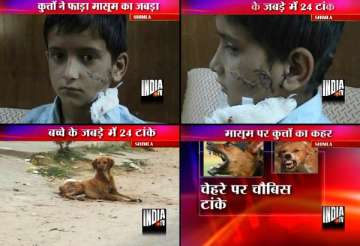 shimla boy gets 24 stitches after stray dogs attack