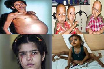 ten big medical anomalies afflicting indians
