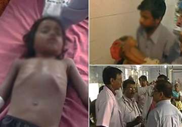 251 children die of encephalitis in bihar