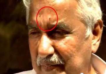 chandy injured in stone pelting cpi m rules out involvement