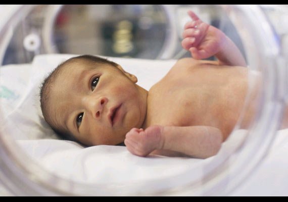 Miracle baby: Born premature, now a healthy baby girl ! | India News ...