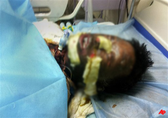 tibetan activist dies immolated himself for protest against