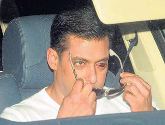Salman Gets Bags Removed From Under His Eyes : Report | Bollywood News –  India TV