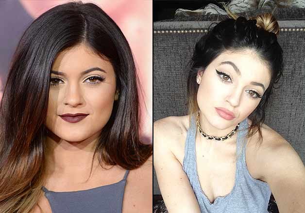 Kylie Jenner Finally Opens Up On Plastic Surgery Lifestyle News India Tv 