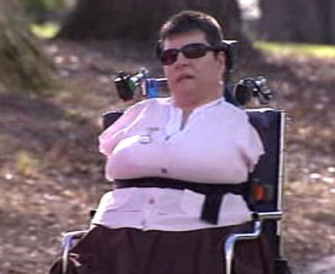 Australian woman wins millions in Thalidomide lawsuit | Hollywood News ...