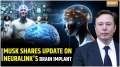 Elon Musk highlights progress of Neuralink during visit in Beijing | Brain Chip | India TV News