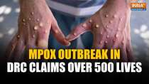 Mpox in DRC: Mpox outbreak in DRC claims over 500 lives, raising concerns over global outbreak