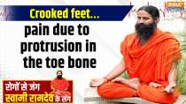 Yoga With Swami Ramdev, 10 July, 2025 : Crooked feet&hellip;pain due to protrusion in the toe bone