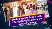 Shahid sports face mask after getting lip injury on sets of 