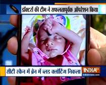 Mumbai: 50-day old baby defeats COVID-19 and brain hemorrhage
