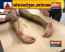 Swami Ramdev shares ayurvedic tips to treat varicose veins