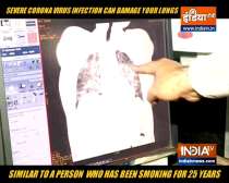 Coronavirus infection can damage your lungs