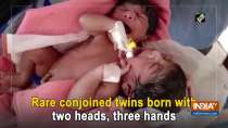 Rare conjoined twins born with two heads, three hands