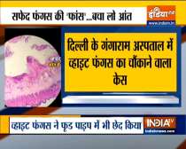 Delhi: Small intestine infected by black fungus 