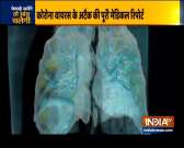 How the novel coronavirus attacks the lungs ?