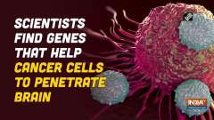 Scientists find genes that help cancer cells to penetrate brain