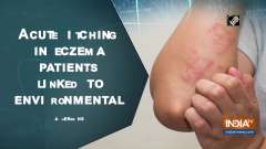 Acute itching in eczema patients linked to environmental allergens